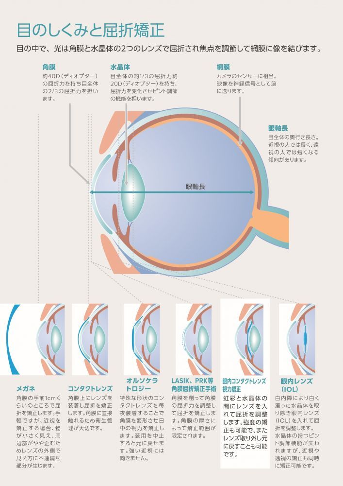 目のしくみと屈折矯正